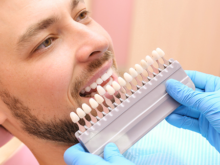 Odontología Estética